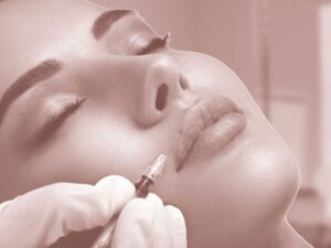 Best-Dermal-Fillers-London